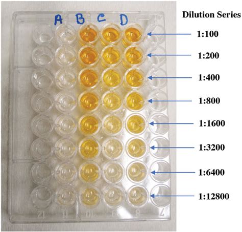 elisa test results interpreted|ELISA Results .
